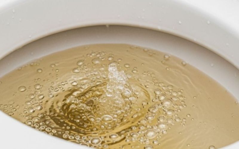 Nhận biết dấu hiệu bồn cầu cần được đổ men vi sinh
